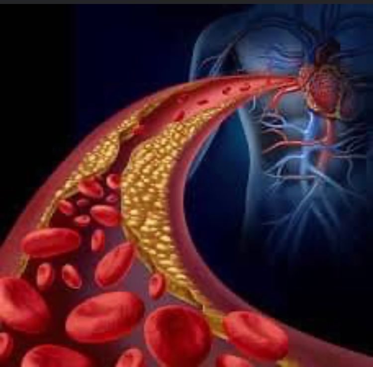 Cardiovascular Risks Chronic Kidney Disease the Virtual Nephrologist