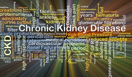 The-Virtual-Nephrologist-CKD-Chronic-Kidney-Disease