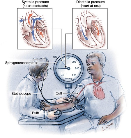 The Virtual Nephrologist - Hypertension Blood pressure